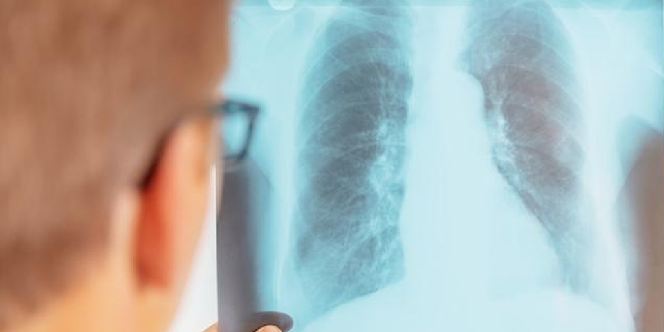 全國肺結(jié)節(jié)患者總數(shù)超1億，無法準(zhǔn)確判斷是否是癌讓他們集體焦慮